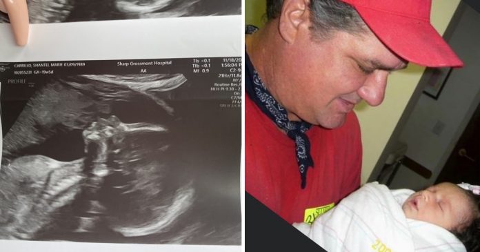 Grávida vê pai falecido beijando seu bebê no ultrassom e imagem viraliza