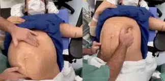 Médico ‘vira’ bebê dentro da barriga da mãe minutos antes do parto e evita cesariana – ASSISTA!