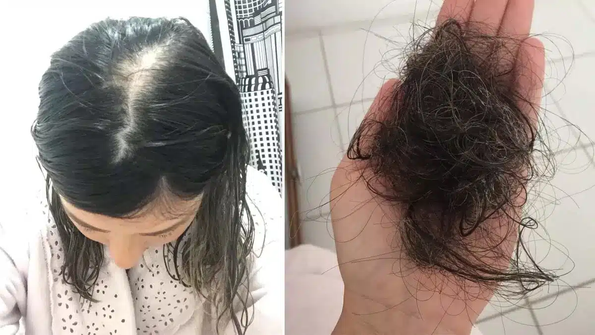 revistapazes.com - Após 2 tratamentos contra o câncer de mama, mulher engravida e dá à luz linda criança - confira o relato