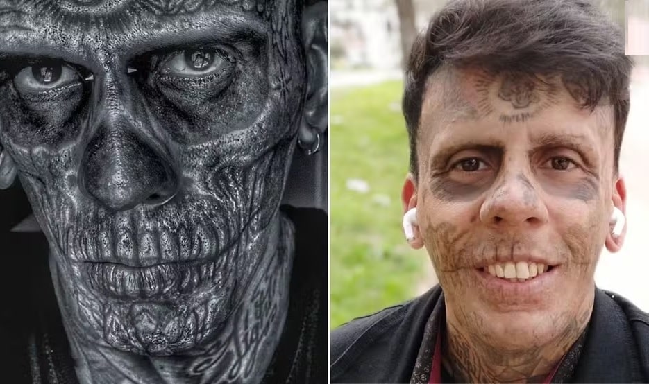 revistapazes.com - Homem mais tatuado do Brasil decide remover tatuagens após tomar decisão surpreendente - veja como ele está hoje